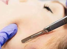 Choose the Top and Professional Dermaplaning in Columbus