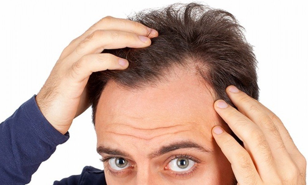 Benefits Of Hair Loss Treatment