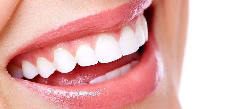 The Power of a Hollywood Smile: How Celebrities Influence Cosmetic Dentistry Trends