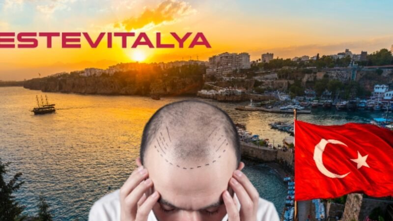 Why Turkey Is Prominent in the Field of Hair Transplantation