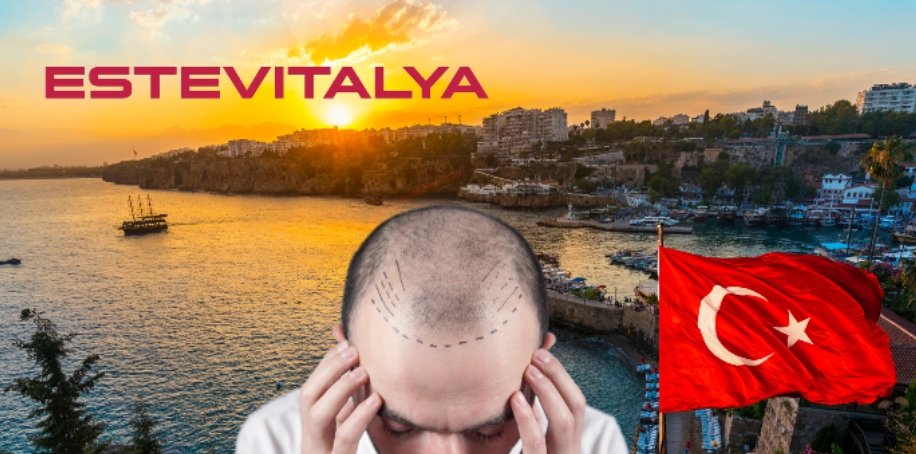 Why Turkey Is Prominent in the Field of Hair Transplantation